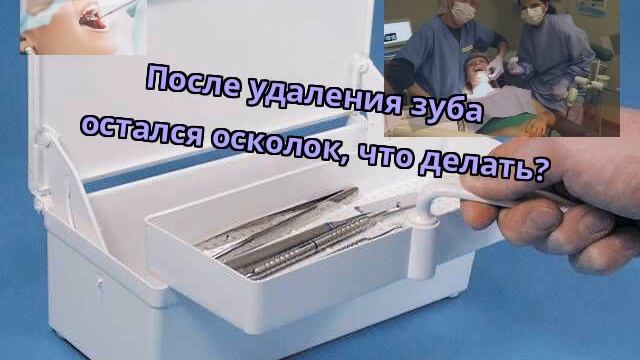 После удаления зуба остался осколок, что делать? смотреть онлайн