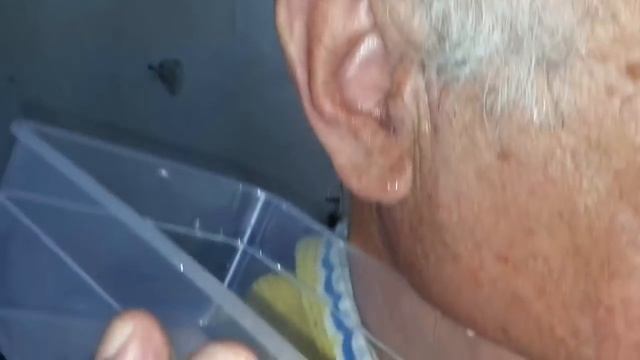 Серная пробка  промывание уха