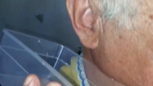 Серная пробка  промывание уха