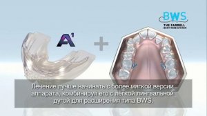 Myobrace для взрослых