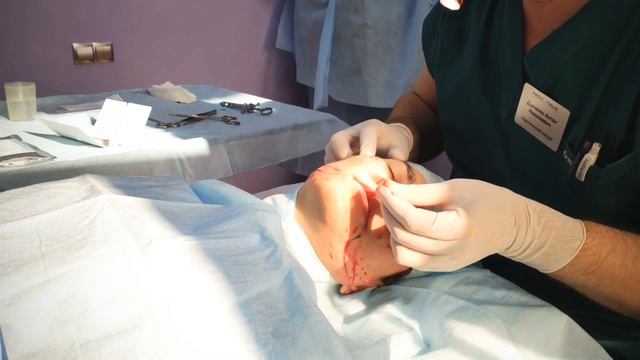 НИТЕВОЙ ЛИФТИНГ APTOS смотреть онлайн