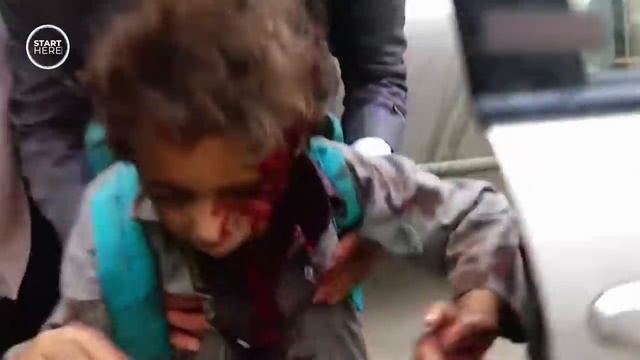 Why Are Millions Starving In Yemen? | Start Here