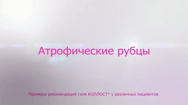 Kollost финал 06 02 2014