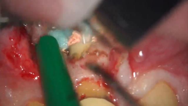 Иван Вьючнов. Micro SxRTx OF Sx смотреть онлайн