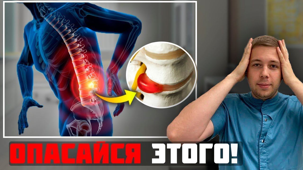 Самая ОПАСНАЯ грыжа диска - грыжа с секвестрацией! Операция НЕИЗБЕЖНА…