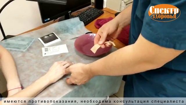 Современная замена гипсу. Ортезы из термопластика ORDEKT. МЦ 