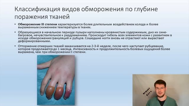 "Первая помощь при обморожении" смотреть онлайн