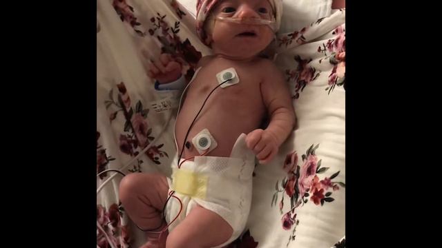 Changing The Narrative With Trisomy 18 And 13