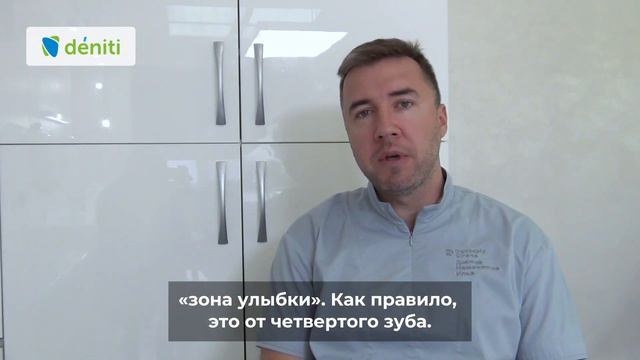 Сколько нужно установить виниров для идеальной улыбки смотреть онлайн