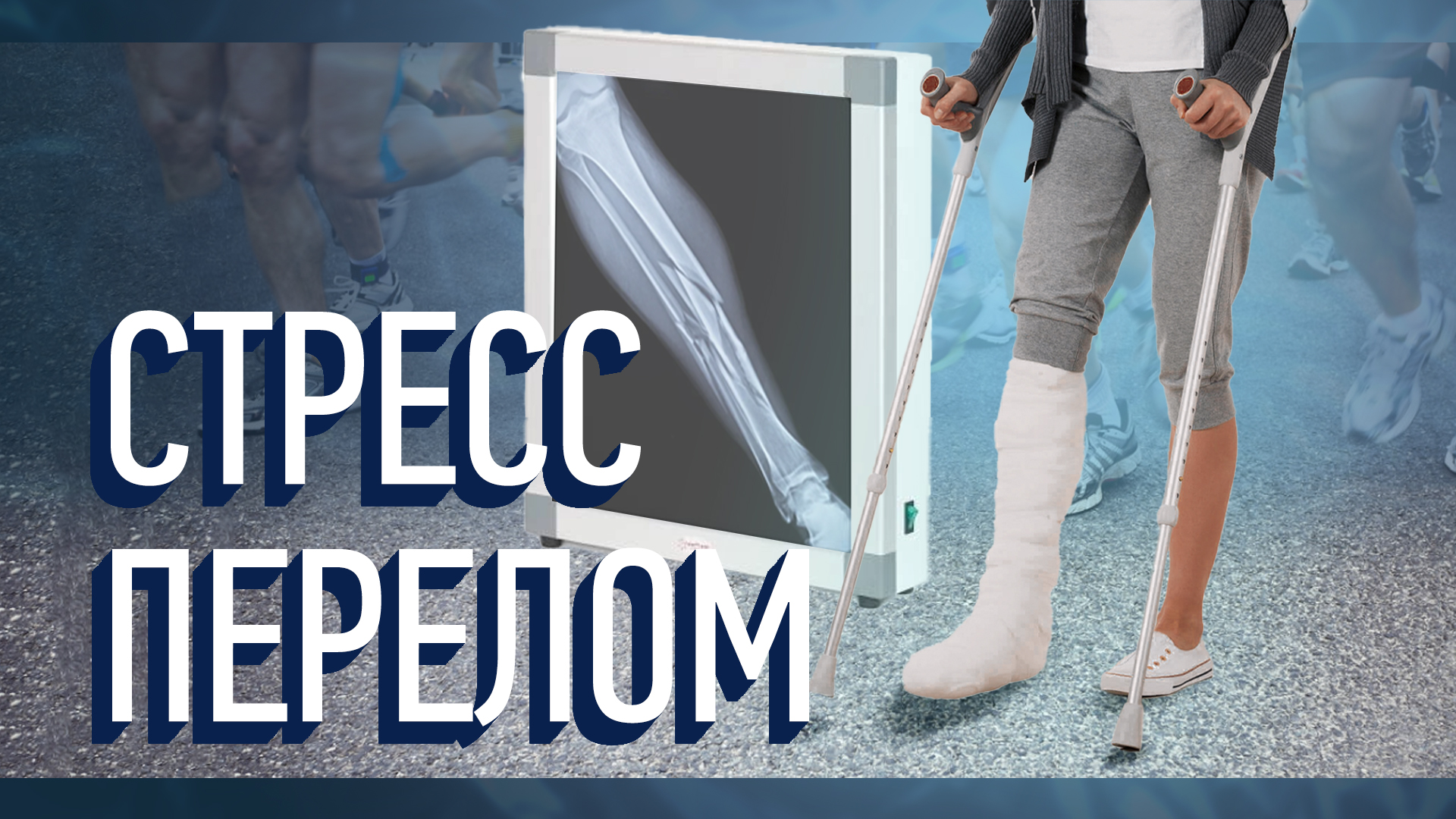 Стресс перелом. Травмы не было, но она есть! смотреть онлайн
