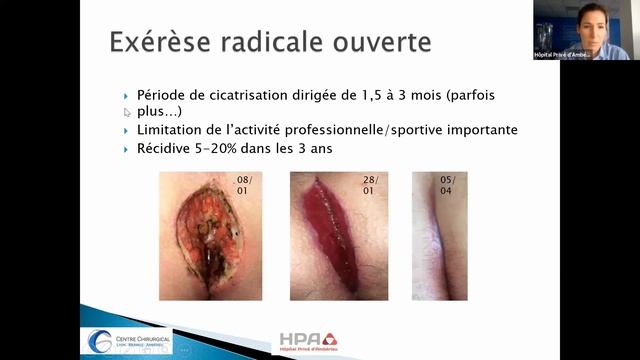 Coordination ville/hôpital pour les urgences générales et digestives смотреть онлайн