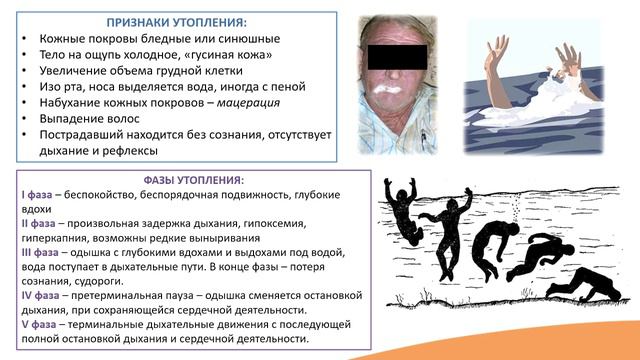 13.5. Утопление. Первая помощь при утоплении смотреть онлайн