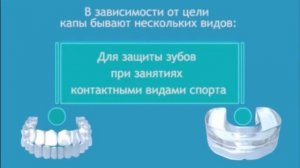 Капы для зубов в Китае