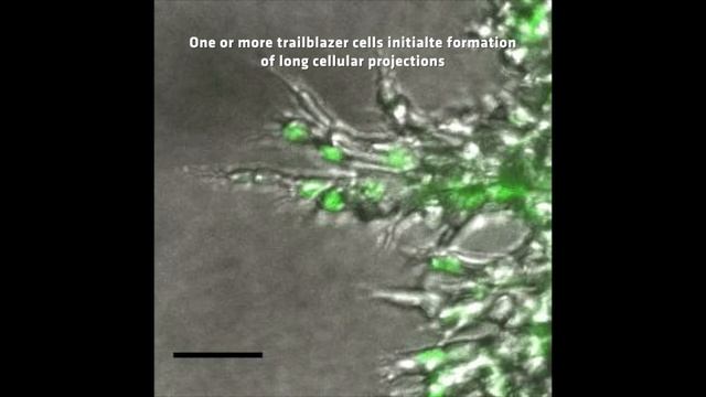 Blazing the trail for metastasis смотреть онлайн