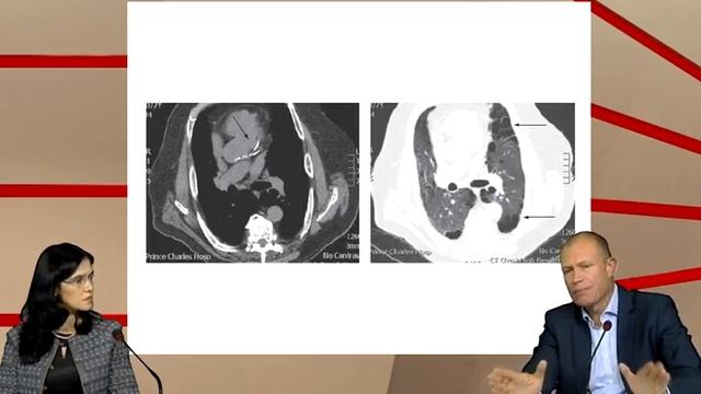 ХОБЛ- диагностика и терапия.m4v смотреть онлайн