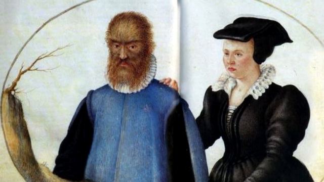 ARQUIVO CONFIDENCIAL #44: PETRUS GONSALVUS, a triste história real que inspirou "A Bela e a Fera" смотреть онлайн