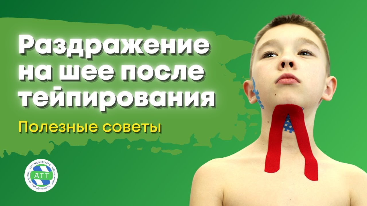 Покраснения и раздражения после тейпов. Полезные советы по тейпированию. смотреть онлайн