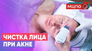 Чистка лица при акне и проблемной коже у косметолога | Курсы косметологии
