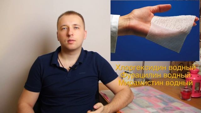 Как помочь себе, если ОБЖЕГСЯ смотреть онлайн