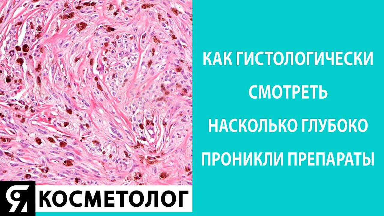 Как гистологически смотреть насколько глубоко проникли препараты смотреть онлайн