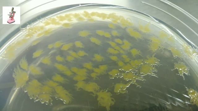 Bordetella hinzi on Nutrient agar смотреть онлайн