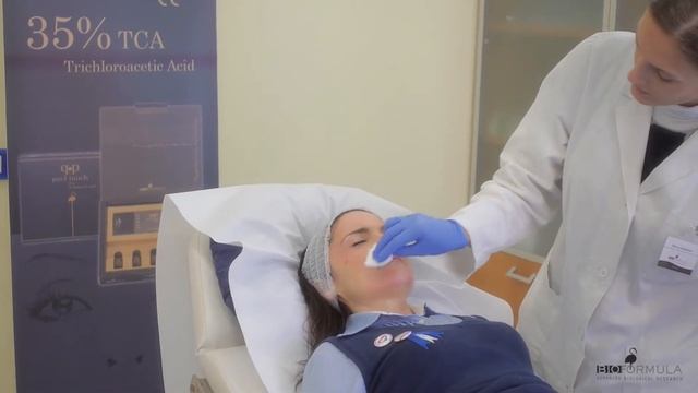 Пилинг Bioformula смотреть онлайн