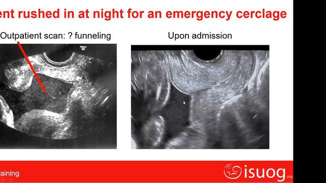 RRC -SLNMCH, Koraput Virtual USG sessions - Date : 11th Feb. 2022 смотреть онлайн