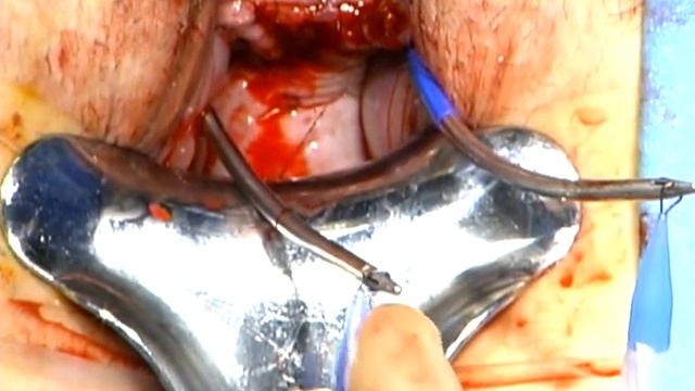 Lynx Procedure смотреть онлайн