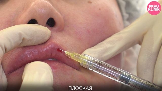 ТОТАЛЬНАЯ БЬЮТИФИКАЦИЯ: НАТАЛЬЯ смотреть онлайн