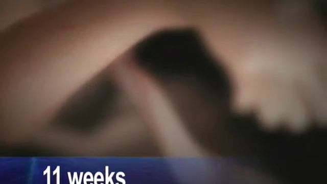 The Abortion Matrix (rough version) Abortion in Biblical Perspective смотреть онлайн
