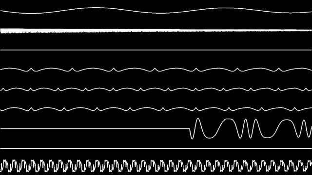 SynaMax - NewPAGA (Oscilloscope View) смотреть онлайн