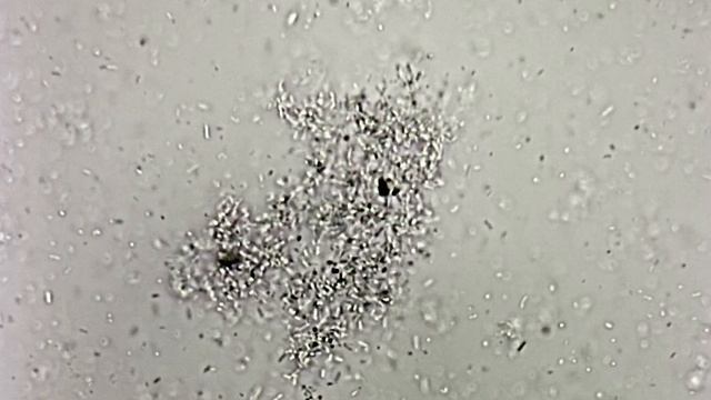 Bacillus subtilis - начало биопленки смотреть онлайн