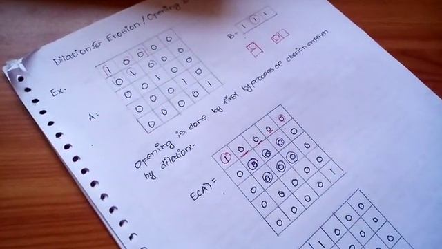 Numerical on Opening & Closing(Dilation & Erosion) Topic:Image Morphology смотреть онлайн