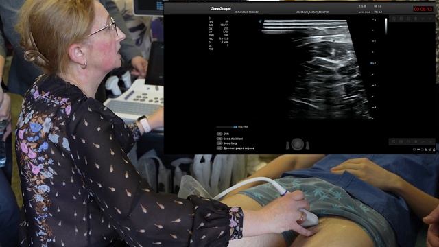 Мастер-класс: Ультразвуковое исследование вен нижних конечностей. Кривошеева Н.В. смотреть онлайн