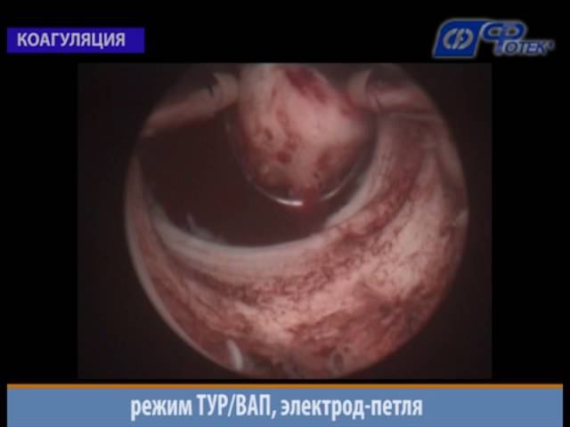 Режим ТУР/ВАП смотреть онлайн