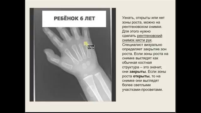 Как увеличить рост смотреть онлайн