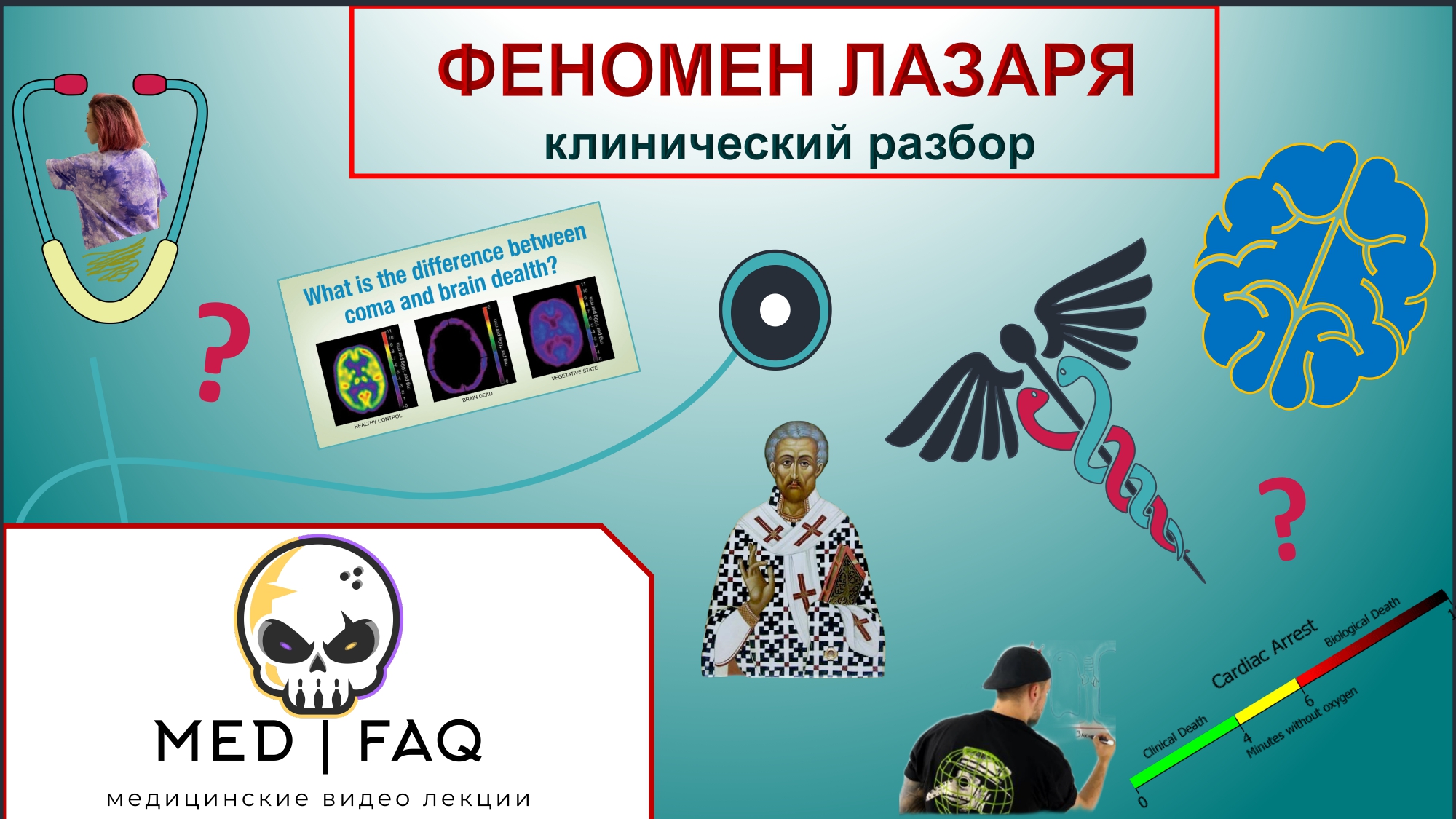 Клинический разбор - Сндром Лазаря