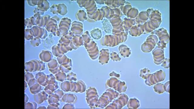 Кровь человека под микроскопом blood under microscope смотреть онлайн