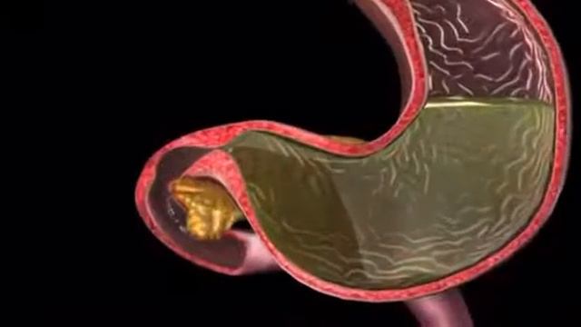 поджелудочной железы это он админ нетрадиционной врач Рахманов т (0779-0559-605856) смотреть онлайн