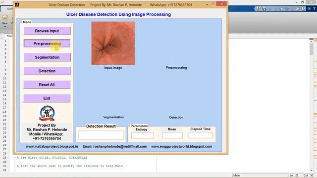 Ulcer Disease Detection Using Matlab смотреть онлайн