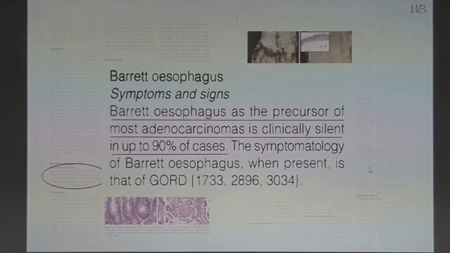 05 Калинин ДВ Морфологическая верификация Пищевода Барретта смотреть онлайн