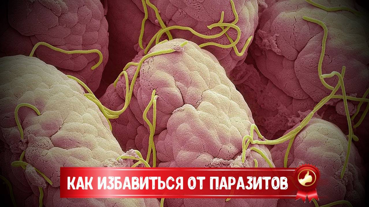 КАК ИЗБАВИТЬСЯ ОТ ПАРАЗИТОВ смотреть онлайн
