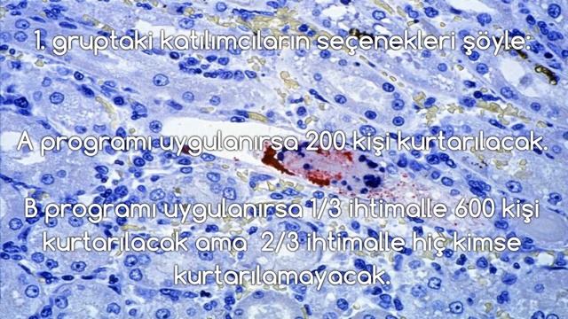 Sosyal Manüpilasyon - Asya Hastalığı Problemi смотреть онлайн