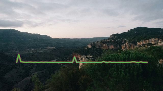 АБИДАТ ШАХБАНОВА - ПРИКОСНОВЕНИЕ 2024 смотреть онлайн