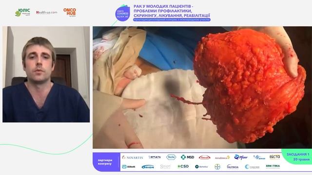Переваги застосування ICG технології візуалізації в онкохірургії смотреть онлайн