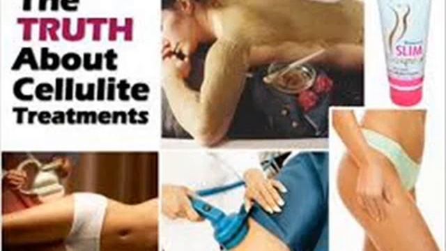 OBESITY موٹاپا मोटापा CELLULITE TREATMENT INFECTION ICSP94 URDU HINDI 1 BBJAN смотреть онлайн
