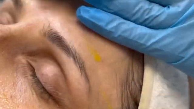 Пілінг BioRePeel чудово підходить до будь-якого типу обличчя і можна робити в різну пору року ? смотреть онлайн