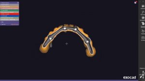 Exocad балочная конструкция All-on-4