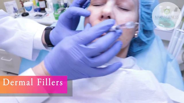 Orlando Expert Physician Injector | Dermal Fillers : Versa, Juvederm, Restylane & Belotero смотреть онлайн