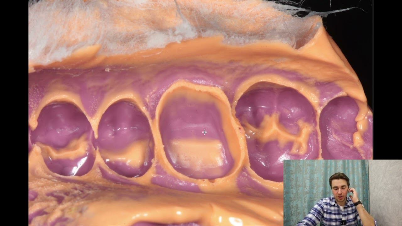 СТОМБУДНИ#32. ОТ ПЛОМБЫ ДО КОРОНКИ ОДИН ШАГ смотреть онлайн